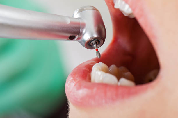 Best Cracked Tooth Emergency Dentist  in Homewood, IL